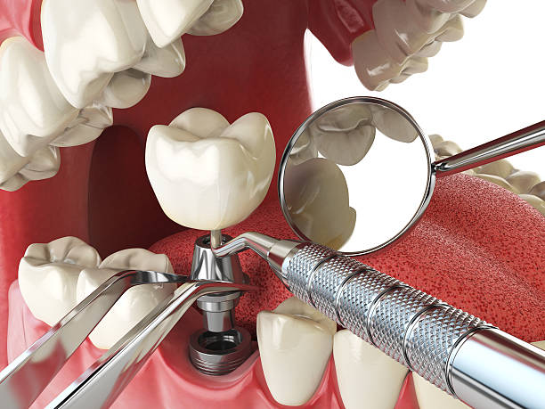 Best Pediatric Emergency Dentist in Chardon, OH